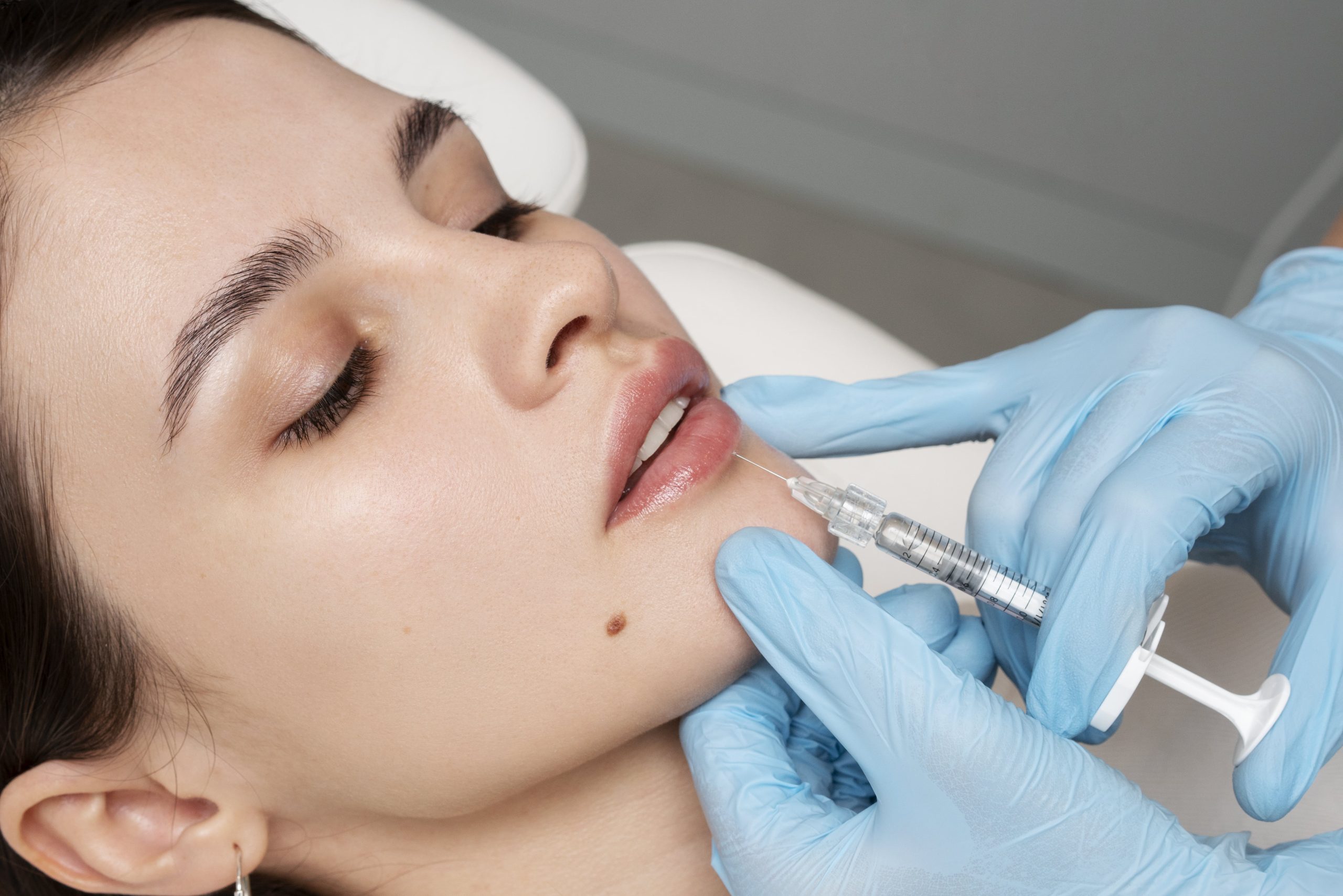 Dermal fillers