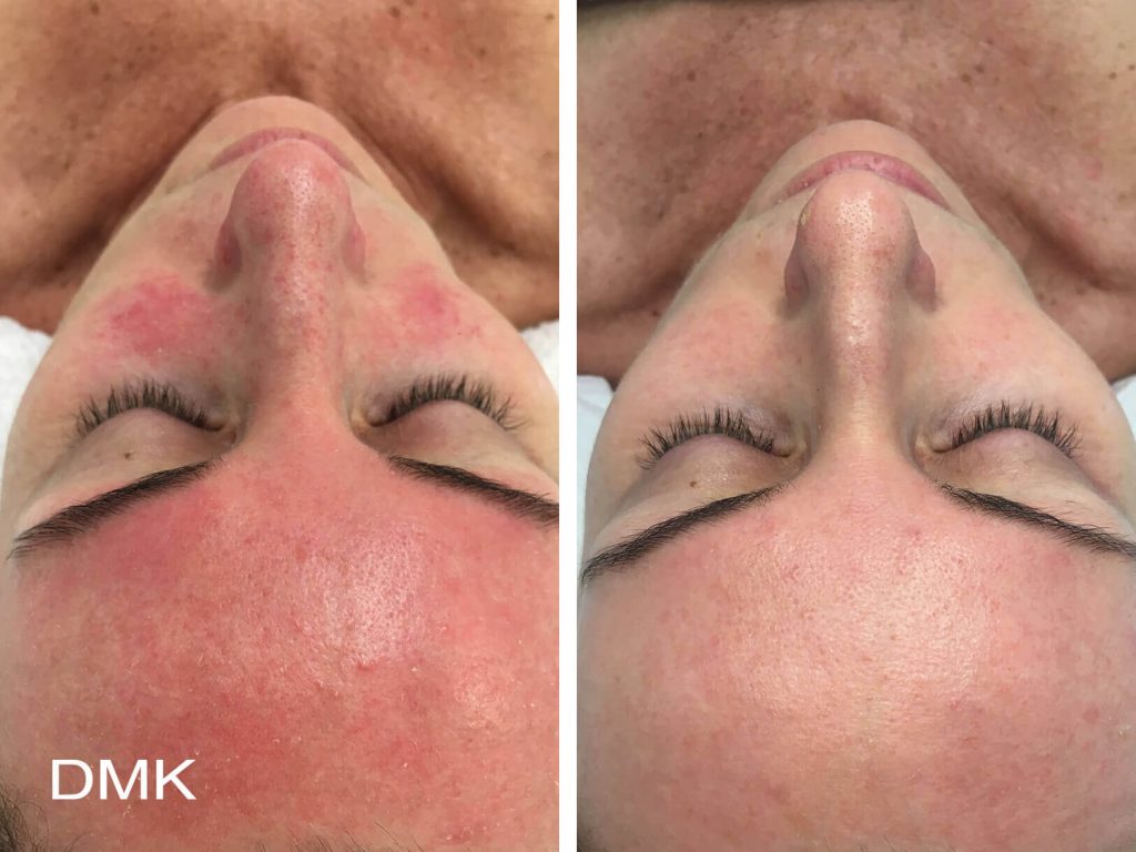 Before & After Case 1