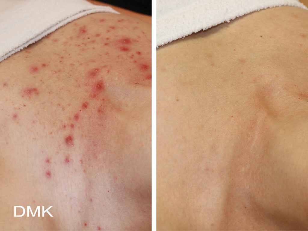 Before & After Case 2