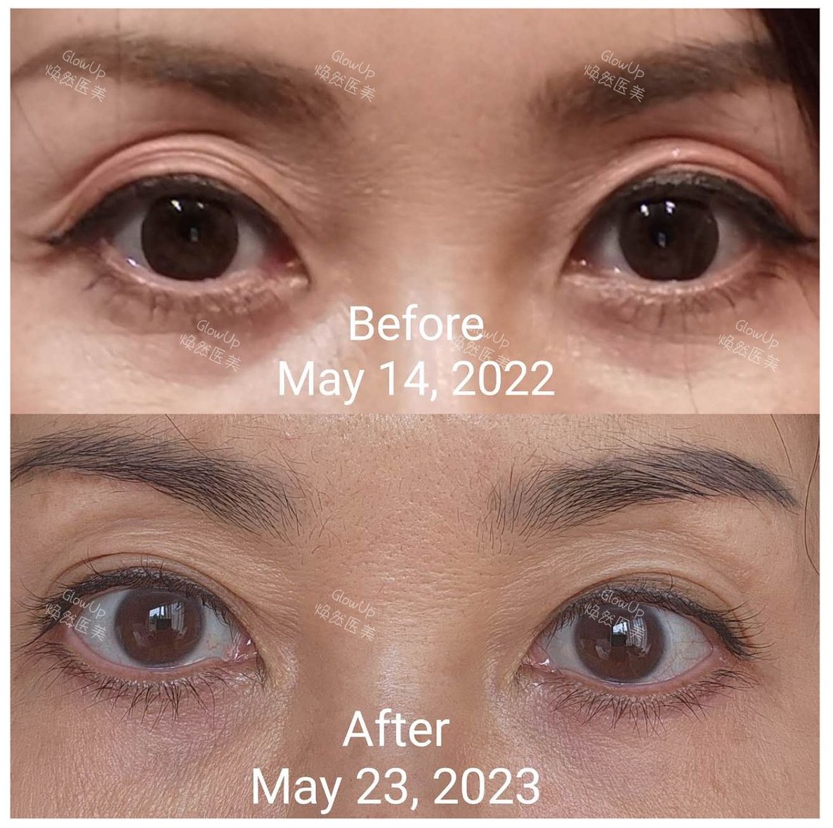 Before & After Case 1