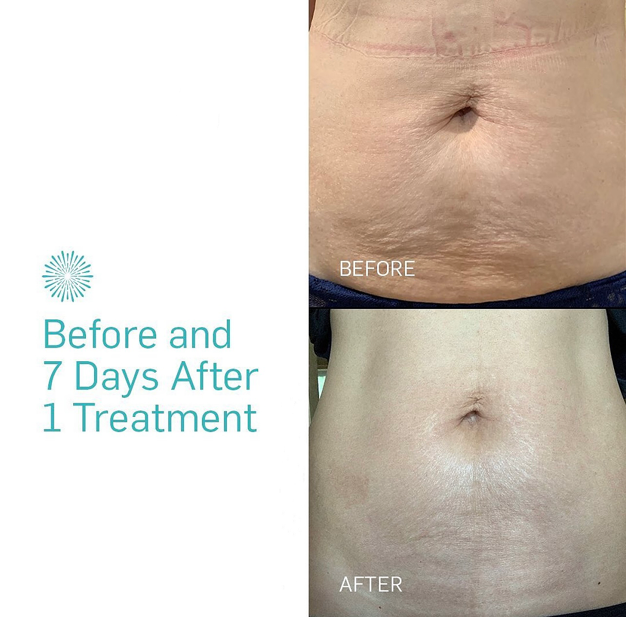 Before & After Case 2