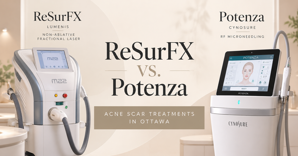 ReSurFX fractional laser vs Potenza RF microneedling for acne scars in Ottawa